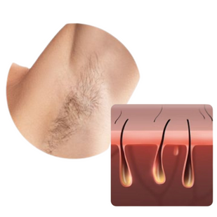 Softer Hair & Skin - After 1 week