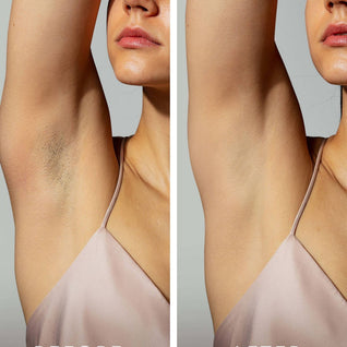 Cyperus Rotundus Serum