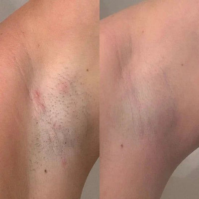 Cyperus Rotundus Serum