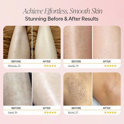 Electric Shaver - No Razor bumps. No ingrown hairs.