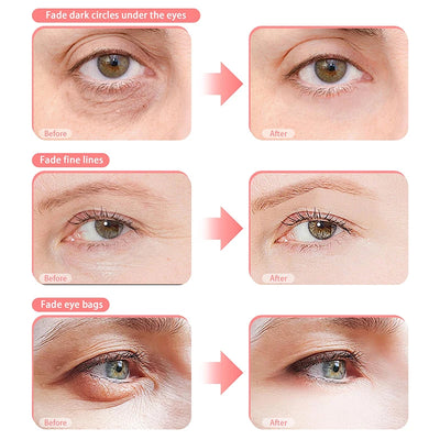 Under Eye Red Light Therapy