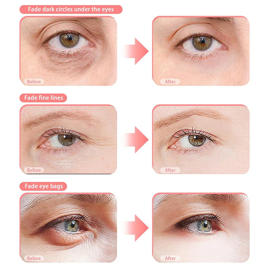 Under Eye Red Light Therapy