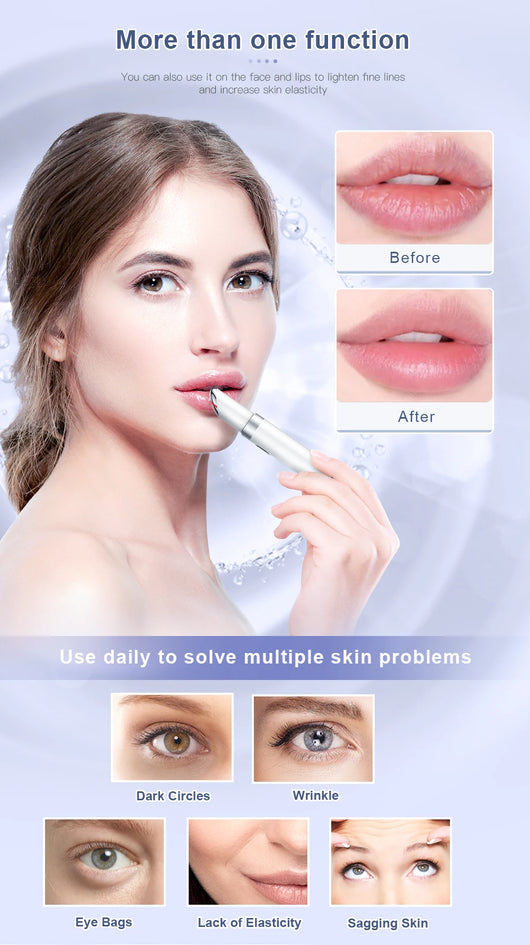 ANLAN Electric Eye Massager Microcurrent Skin Lifting Reduce Wrinkles Remove Dark Circles Hot Vibration Skincare Beauty Device