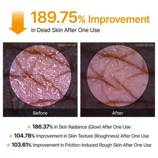 Kojic Turmeric Body Peel Spray
