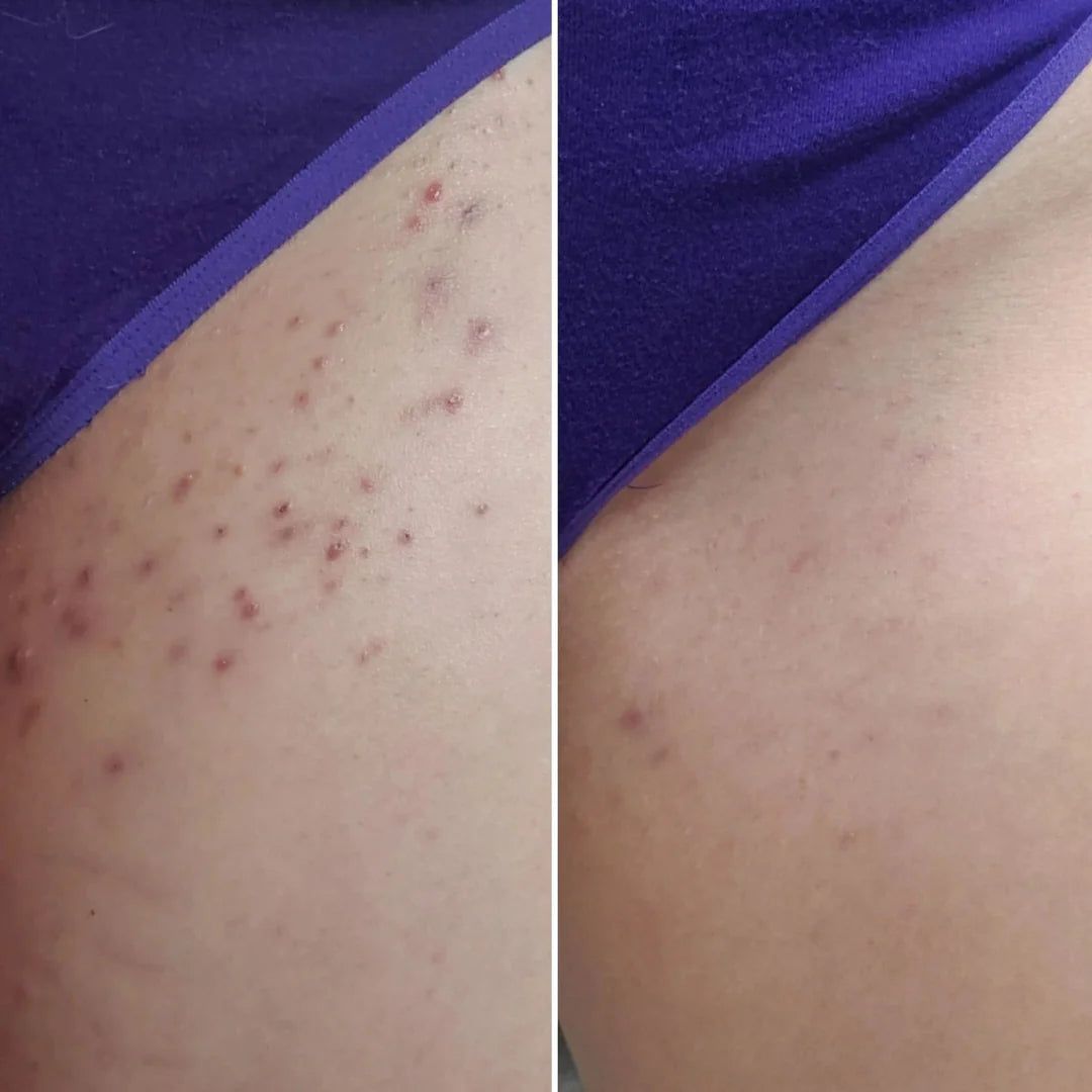 Are you tired of seeing unwanted hair grow back the next day?