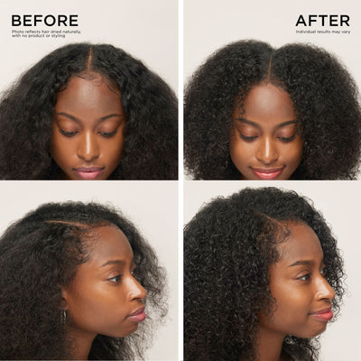 Dr. Groot Scalp Revitalizing Serum for Fuller Thicker Hair