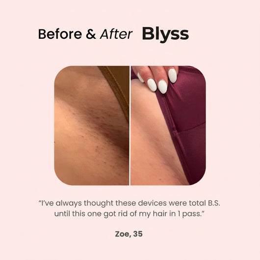Electric Shaver - No Razor bumps. No ingrown hairs.